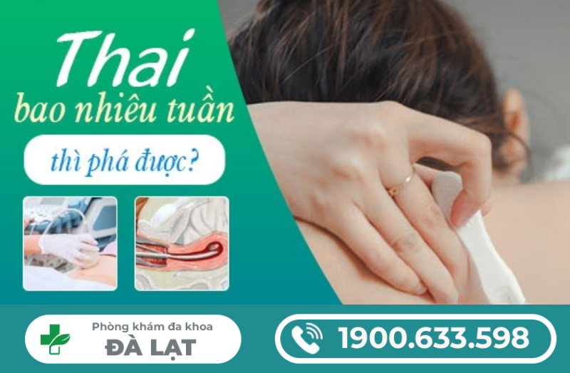 Hình ảnh minh họa